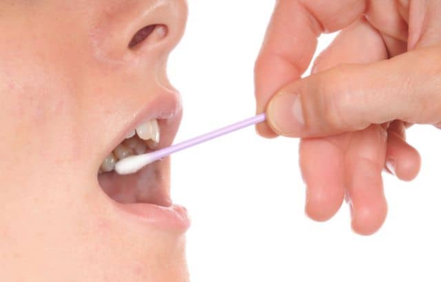 Saliva Sampling